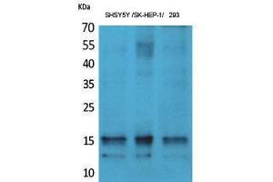 Western Blotting (WB) image for anti-Synuclein, alpha (SNCA) (pTyr125) antibody (ABIN3173525) (SNCA antibody  (pTyr125))