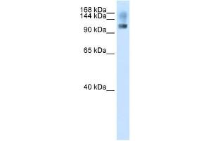 SFRS8 antibody used at 2. (SFRS8 antibody  (N-Term))
