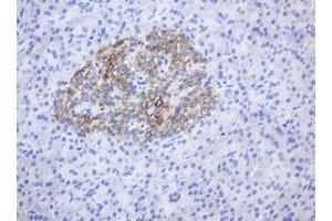 Image no. 1 for anti-CD99 (CD99) antibody (ABIN1497386) (CD99 antibody)