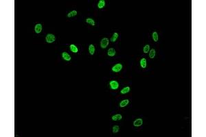 Immunofluorescent analysis of Hela cells using ABIN7139669 at dilution of 1:100 and Alexa Fluor 488-congugated AffiniPure Goat Anti-Rabbit IgG(H+L) (HIST1H3A antibody  (3meLys36))