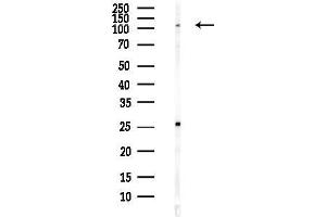 anti-Family with Sequence Similarity 83, Member B (FAM83B) antibody