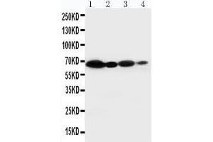 Anti-NOX2/gp91phox antibody, Western blotting Lane 1: HELA Cell Lysate Lane 2: JURKAT Cell Lysate Lane 3: MCF-7 Cell Lysate Lane 4: SMMC Cell Lysate (CYBB antibody  (Middle Region))