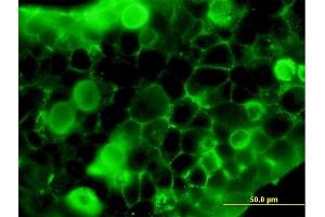 Immunofluorescence of purified MaxPab antibody to FLT1 on 293 cell. (FLT1 antibody  (AA 1-687))