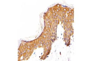 Immunohistochemistry (IHC) image for anti-Epidermal Growth Factor (EGF) (AA 259-287), (N-Term) antibody (ABIN5532552)