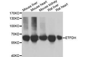 Western blot analysis of extracts of various cell lines, using ETFDH antibody.