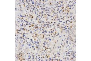 Immunohistochemistry (IHC) image for anti-Secretin Receptor (SCTR) antibody (ABIN3017416) (SCTR antibody)