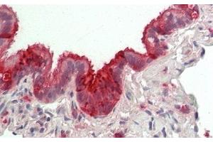 Detection of CC16 in Human Lung Tissue using Polyclonal Antibody to Clara Cell Protein 16 (CC16) (SCGB1A1 antibody  (AA 23-91))