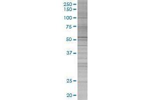 CDC42EP1 transfected lysate.