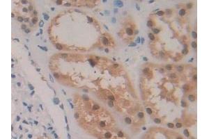 Immunohistochemistry (IHC) image for anti-Glutathione Reductase (GSR) (AA 44-522) antibody (ABIN7433438)