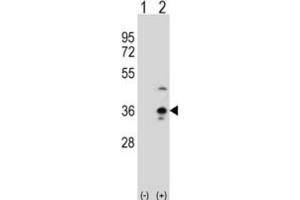 Western Blotting (WB) image for anti-Collectin Sub-Family Member 11 (COLEC11) antibody (ABIN3002827) (COLEC11 antibody)