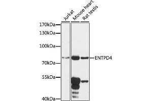 Western blot analysis of extracts of various cell lines, using ENTPD4 antibody (ABIN7266893) at 1:1000 dilution. (ENTPD4 antibody  (AA 350-470))