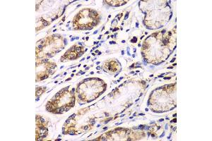 Immunohistochemistry of paraffin-embedded human colon using RPN1 antibody. (RPN1 antibody)