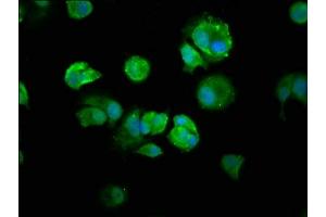 Immunofluorescence staining of MCF-7 cells with ABIN7161781 at 1:250, counter-stained with DAPI. (NFKB1 antibody  (AA 1-961))