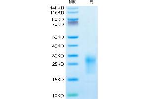 Mouse TIGIT on Tris-Bis PAGE under reduced condition. (TIGIT Protein (AA 26-143) (His tag))