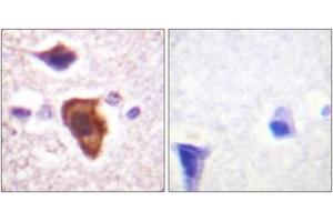 Immunohistochemistry analysis of paraffin-embedded human brain tissue, using CD88/C5aR (Ab-338) Antibody. (C5AR1 antibody  (AA 301-350))