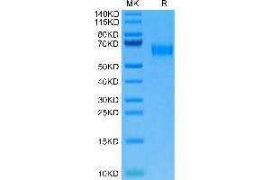 AMIGO2 Protein (AA 39-397) (His tag)