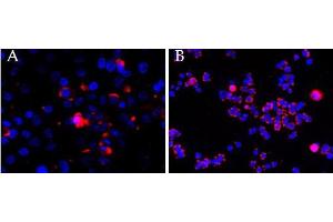 CEP290 antibody  (Internal Region)