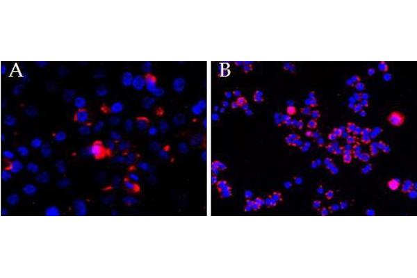 CEP290 antibody  (Internal Region)