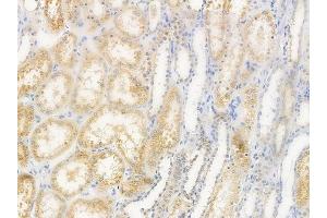 ABIN6259408 and ABIN6276179 at 1/100 staining human normal kidney tissue by IHC-P.