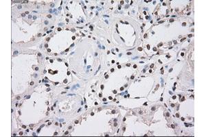 Immunohistochemical staining of paraffin-embedded endometrium tissue using anti-FHmouse monoclonal antibody. (FH antibody)
