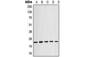 Western blot analysis of Alpha-crystallin B (pS19) expression in MCF7 (A), mouse spleen (B), mouse eye (C), rat liver (D), rat eye (E) whole cell lysates. (CRYAB antibody  (N-Term, pSer19))