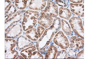 Immunohistochemical staining of paraffin-embedded Human liver tissue using anti-RAB17 mouse monoclonal antibody. (RAB17 antibody)