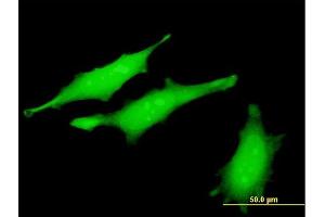 Immunofluorescence of monoclonal antibody to RRM2B on HeLa cell. (RRM2B antibody  (AA 3-84))