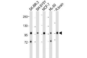 All lanes : Anti-PCDH20 Antibody (Center) at 1:2000 dilution Lane 1: SK-BR-3 whole cell lysate Lane 2: SH-SY5Y whole cell lysate Lane 3: MCF-7 whole cell lysate Lane 4: HL-60 whole cell lysate Lane 5: Rat brain whole cell lysate Lysates/proteins at 20 μg per lane.