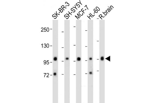 PCDH20 antibody  (AA 445-472)