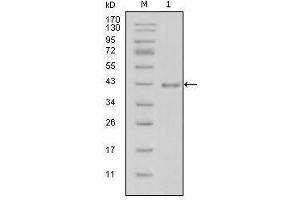 Western Blot showing LAMB1 antibody used against truncated LAMB1-His recombinant protein (1). (Laminin antibody  (AA 31-270))