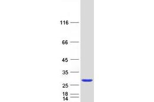 Validation with Western Blot (RAB39B Protein (Myc-DYKDDDDK Tag))