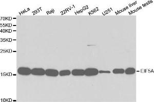 Western blot analysis of extracts of various cell lines, using EIF5A antibody. (EIF5A antibody  (AA 1-154))