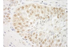 Immunohistochemistry (IHC) image for anti-AT Rich Interactive Domain 3B (BRIGHT-Like) (ARID3B) (AA 100-150) antibody (ABIN7448418)