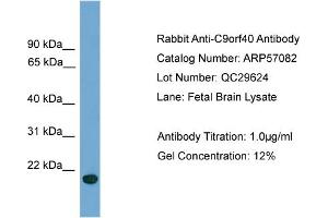 WB Suggested Anti-C9orf40  Antibody Titration: 0. (C9orf40 antibody  (Middle Region))