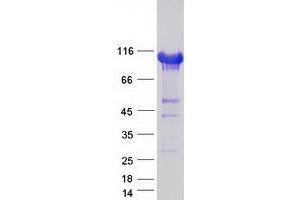 Validation with Western Blot (LSD1 Protein (Transcript Variant 1) (Myc-DYKDDDDK Tag))