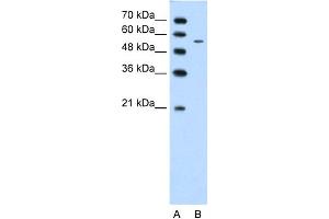 WB Suggested Anti-CHST7 Antibody Titration:  1. (CHST7 antibody  (Middle Region))