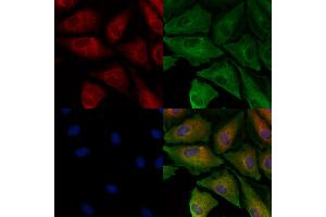 ABIN6260104 and ABIN6278139 staining  cells by IF/ICC. (ATG4A antibody  (N-Term))