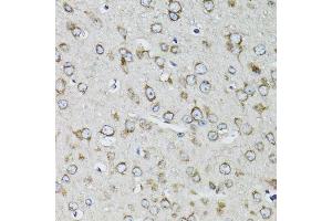 Immunohistochemistry of paraffin-embedded mouse brain using RPS10 antibody. (RPS10 antibody  (AA 1-165))
