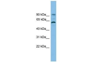 ANKRD5 antibody used at 1 ug/ml to detect target protein. (ANKRD5 antibody  (N-Term))