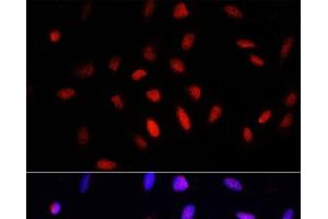 Immunofluorescence analysis of U2OS cells using COMMD1 Polyclonal Antibody at dilution of 1:100.