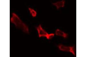 ABIN6274826 staining HepG2 by IF/ICC. (ALDH1B1 antibody  (Internal Region))