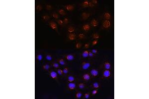 Immunofluorescence analysis of C6 cells using GOLG Rabbit pAb (ABIN6129790, ABIN6141266, ABIN6141267 and ABIN6214379) at dilution of 1:100 (40x lens). (GOLGA4 antibody  (AA 1-150))