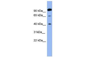 WB Suggested Anti-NTSR1 Antibody Titration:  0. (NTSR1 antibody  (N-Term))