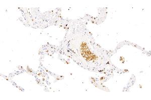 Detection of GYPA in Human Lung Tissue using Polyclonal Antibody to Glycophorin A (GYPA) (CD235a/GYPA antibody  (AA 20-91))