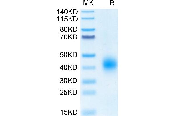 BTLA Protein (His-Avi Tag,Biotin)