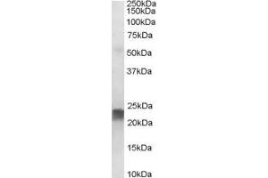 ABIN185188 staining (0. (Transgelin antibody  (C-Term))