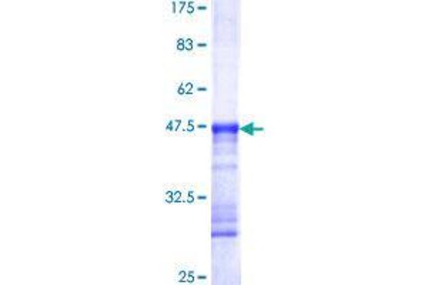 DDIT4 Protein (AA 1-99) (GST tag)