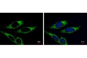 ICC/IF Image Adenylate kinase 3 antibody [N1C3] detects Adenylate kinase 3 protein at mitochondria by immunofluorescent analysis. (AK4 antibody)