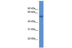 Western Blot showing Rod1 antibody used at a concentration of 1-2 ug/ml to detect its target protein. (PTBP3 antibody  (N-Term))