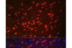 Immunofluorescence analysis of Rat brain using TRPM2 Polyclonal Antibody at dilution of 1:100. (TRPM2 antibody)